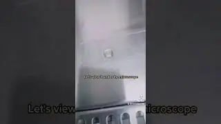 White particles in urine 