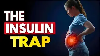 5 Signs of Insulin Resistance Top Endocrinologist Reveals