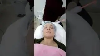 Cilt bakım leke tedavi. High frekans