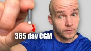I Tested The Eversense CGM Sensor. Is It Worth It?