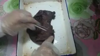 Stomach ( revision )