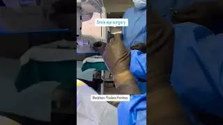 Smile Eye Surgery! Bladeless, Flapless, Painless 