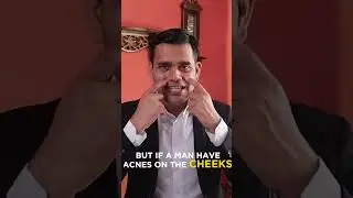 3 Reasons For Acne | Why We Get Acne - Dr. Vivek Joshi