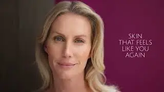 Transform Your Skin with Sculptra: Real You Clinic's Guide to Natural Collagen Restoration