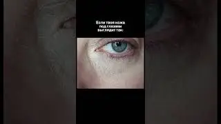 Тг дерматолога - mariiamilli