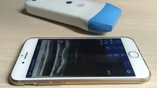 Wireless USG 128 Element Ultrasound Scan linear Probe MSLPU41 for Iphone