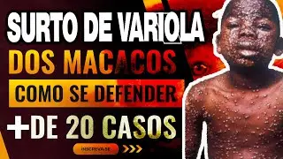 Varíola dos macacos: quais os sintomas e como se transmite