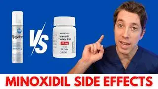 Is Minoxidil SAFE ?! | Hair Surgeon Review