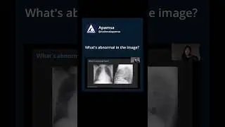 Rads case challenge