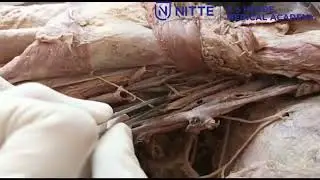 Demonstration of axillary artery and brachial plexus final