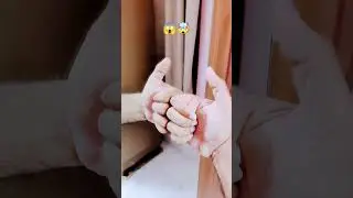 Crazy finger #thumbsup  #thumbnail #youtubeshorts
