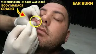 TURKISH BARBER SKIN CARE - MASSAGE 💈 EAR BURN 💈 CRACKS 💈 ASMR head,face,ear,arm,palm,back, massage
