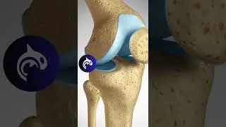 See how an ACL is reconstructed using a Hamstring Tendon Graft - 3D Animation 