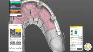EXOCAD TUTORIAL 2015 - by Michael Anger - All on 4