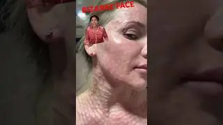 BIZARRE FACE APPEARANCE  After BOOSTING