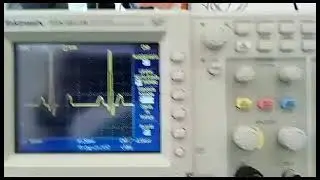 Simulador de ECG con ESP32