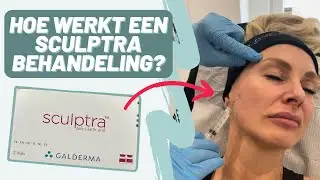 Wat is Sculptra?