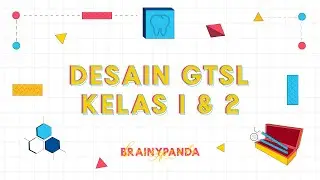 Prostho: Design Considerations for GTSL Classes 1 and 2 | Brainy Panda