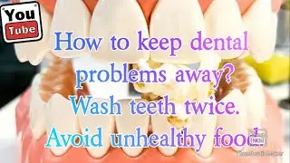 How to keep dental problems away?