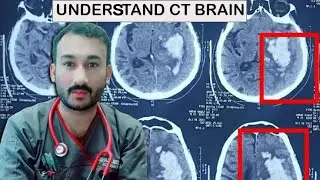Understand CT brain ; Basic of CT brain , Density on CT brain