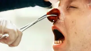 Man GORILLA GLUES Clown Nose Stuck, Instantly Regrets It (Movie Recap)