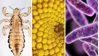 हमने बेक्टेरिआस को माइक्रोस्कोप में देखा #experiment #science #bacteria #microscope #sciencefacts
