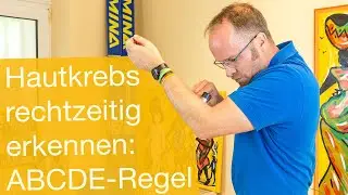 Hautkrebs rechtzeitig erkennen ✅ ABCDE-Regel