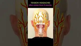 Tension Headache Exercises.
