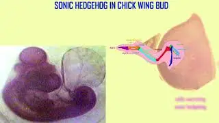 sonic hedgehog in embryonic limb formation