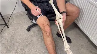 How to relieve knee pain?! Myopressure