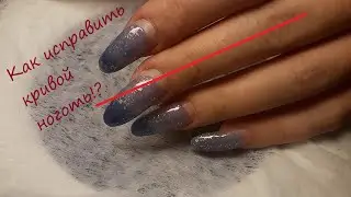 Как исправить криво растущий ноготь?!