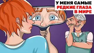 У Меня Самые Редкие Глаза В Мире | Анимированная История