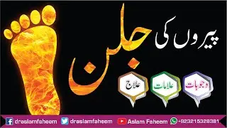 Burning Feet Causes, Symptoms and How can it be treated ? Urdu/Hindi | Pao ki jalan ka elaj