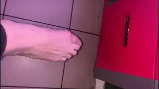 упал на ногу чайник