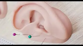 Можно ли массажировать зоны на ушной раковине вместо иглоукалывания?