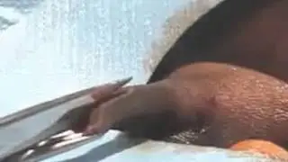 Мужское обрезание Медицинский метод