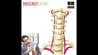 Cracking your neck can be Dangerous & lead to Stroke