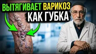 Варикоз реально лечится дома! Советы Доктора Штерна.