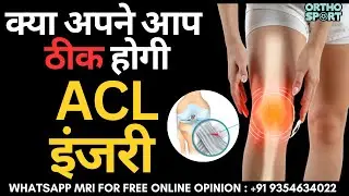 क्या अपने आप ठीक होगी ACL Ligament इंजरी ? Heal your ACL Tear without Surgery !