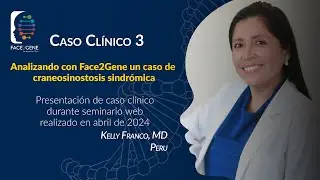 La Dra. Kelly Franco emplea Face2Gene para estudiar un caso de craneosinostosis sindrómica