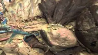 Thoracic Cavity part 3