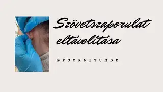 Szövetszaporulat eltávolítása a fülcimpáról