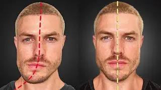 How to Fix Jaw & Face Asymmetry (FOREVER)