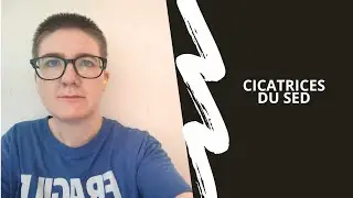 Les différentes cicatrices dans le SED