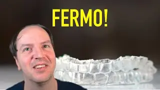 Retainer: come funziona, perché e quanto tenerlo?