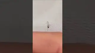 Затролил комара