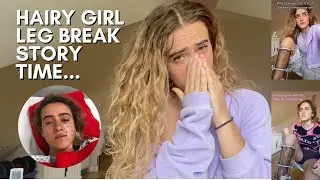 HORRIFYING LEG BREAK STORY - Hairy Leg TikTok Girl