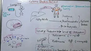 DKA | Diabetic Ketoacidosis | Ketone bodies | Ketosis | Ketonemia | Ketonuria