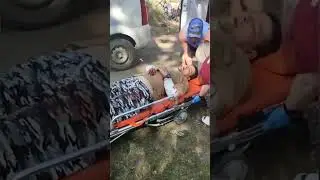 Огромный пёс перегрыз обе руки зоозащитнику