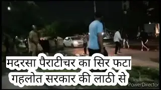 संविदाकर्मचारियों को पुलिस ने दौड़ा-दौड़ा कर पीटा, MPT टीचर का सिर फटा कॉन्ग्रेस की सरकार में